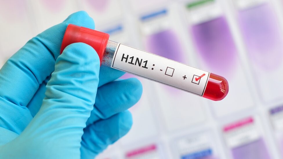 Mão enluvada segura amostra cujo rótulo indica ser positiva para H1N1
