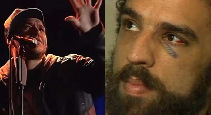 Montagem de fotos de Chorão, no palco, e Camelo, de olho roxo.