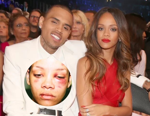 Chris Brown e Rihanna em evento, e detalhe do rosto dela após a agressão, com as marcas ao redor dos olhos, e nos lábios