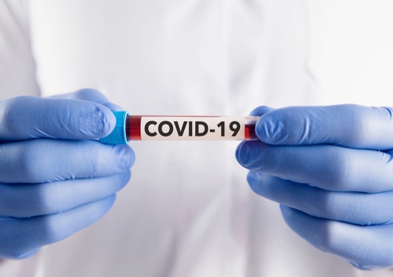 Mãos enluvadas seguram uma amostra rotulada “COVID-19“